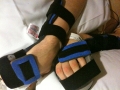 Hand Braces