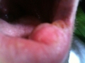 Biting