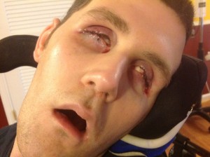 Austin Vantrease Parole: We Must Take Sides – We Got This!